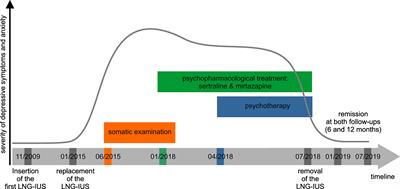 Depressive Disorder With Panic Attacks After Replacement of an Intrauterine Device Containing Levonorgestrel: A Case Report